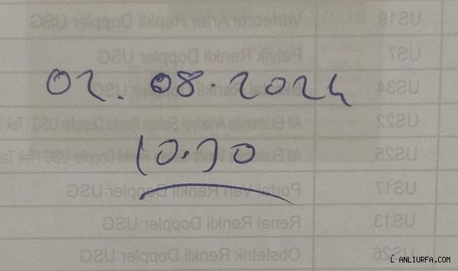 Urfa'da bu kare güne damga vurdu!