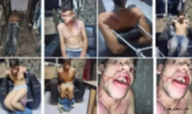 Korkunç görüntüler! Şanlıurfalı gence elektrik verip, dişlerini söktüler!