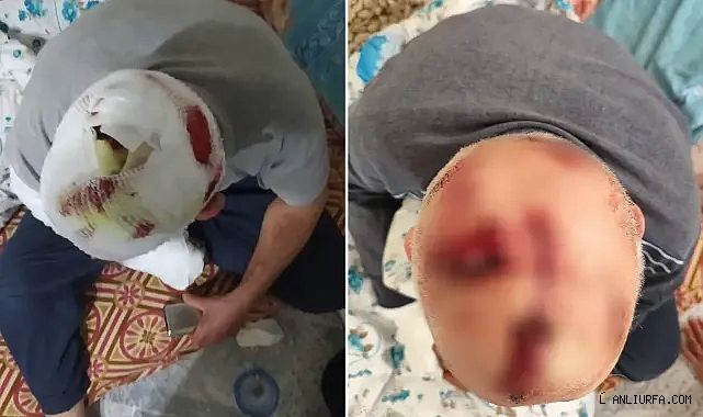 Şanlıurfa'da damat dehşeti! Kayınbabanın kafasına onlarca dikiş atıldı!