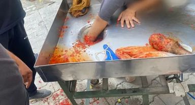 Şanlıurfa'da genç kız elini salça makinesine kaptırdı!